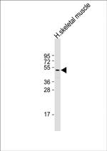 ZDHHC9 Antibody in Western Blot (WB)