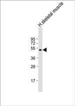 ZDHHC9 Antibody in Western Blot (WB)