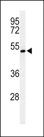 ZDHHC9 Antibody in Western Blot (WB)