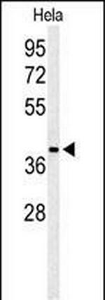 ADPRHL2 Antibody in Western Blot (WB)