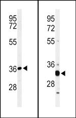 ST8SIA4 Antibody in Western Blot (WB)