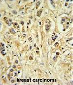 ZNF202 Antibody in Immunohistochemistry (Paraffin) (IHC (P))