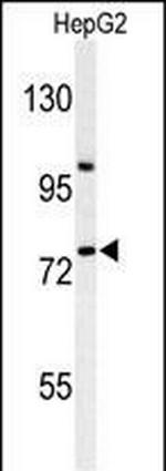 ZNF202 Antibody in Western Blot (WB)