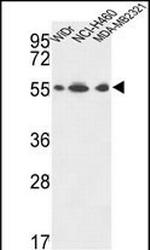 ATP5A1 Antibody in Western Blot (WB)