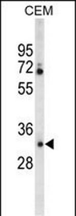 Carbonic Anhydrase VI Antibody in Western Blot (WB)