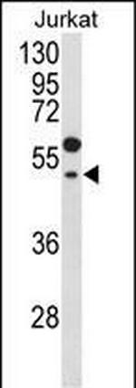 GNAT1 Antibody in Western Blot (WB)