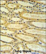 HSD17B11 Antibody in Immunohistochemistry (Paraffin) (IHC (P))