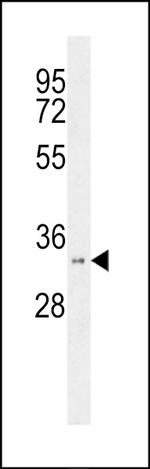 HSD17B11 Antibody in Western Blot (WB)