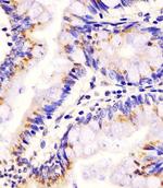 PLA2G7 Antibody in Immunohistochemistry (Paraffin) (IHC (P))