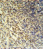 PLA2G7 Antibody in Immunohistochemistry (Paraffin) (IHC (P))