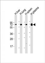 PLA2G7 Antibody in Western Blot (WB)