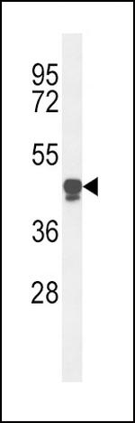 PLA2G7 Antibody in Western Blot (WB)