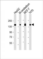 GLG1 Antibody in Western Blot (WB)