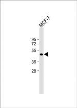 ETS2 Antibody in Western Blot (WB)