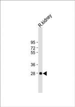 BSND Antibody in Western Blot (WB)