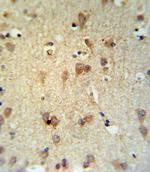 LCAT Antibody in Immunohistochemistry (Paraffin) (IHC (P))