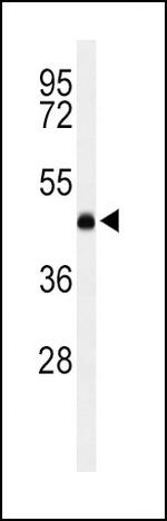 LCAT Antibody in Western Blot (WB)