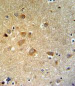 GTSE1 Antibody in Immunohistochemistry (Paraffin) (IHC (P))