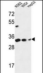 PYCR1 Antibody in Western Blot (WB)