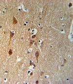 SMAD3 Antibody in Immunohistochemistry (Paraffin) (IHC (P))