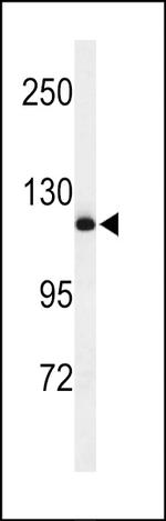 NEDD4 Antibody in Western Blot (WB)