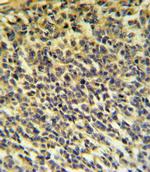 PLA2G6 Antibody in Immunohistochemistry (Paraffin) (IHC (P))