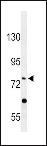 PLA2G6 Antibody in Western Blot (WB)