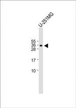 BASP1 Antibody in Western Blot (WB)