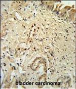 ID4 Antibody in Immunohistochemistry (Paraffin) (IHC (P))