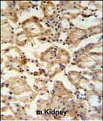 RHBG Antibody in Immunohistochemistry (Paraffin) (IHC (P))