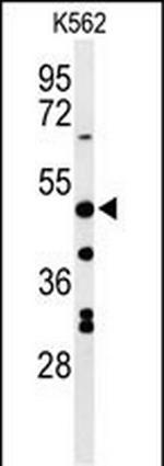 RHBG Antibody in Western Blot (WB)