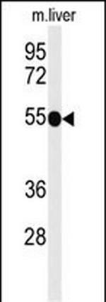 CD30 Antibody in Western Blot (WB)