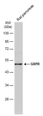 GRPR Antibody in Western Blot (WB)