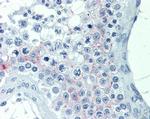 LPAR3 Antibody in Immunohistochemistry (Paraffin) (IHC (P))