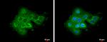 ABR Antibody in Immunocytochemistry (ICC/IF)