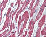 ACVRL1 Antibody in Immunohistochemistry (Paraffin) (IHC (P))