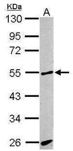 ACVRL1 Antibody in Western Blot (WB)