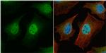 Survivin Antibody in Immunocytochemistry (ICC/IF)