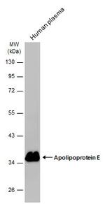 APOE Antibody in Western Blot (WB)