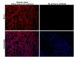 Bcl-2 Antibody in Immunohistochemistry (Paraffin) (IHC (P))