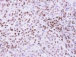 RecQ1 Antibody in Immunohistochemistry (Paraffin) (IHC (P))