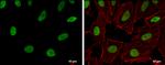 RecQ1 Antibody in Immunocytochemistry (ICC/IF)