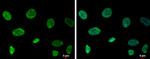 RECQ1 Antibody in Immunocytochemistry (ICC/IF)