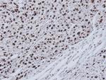 RECQ1 Antibody in Immunohistochemistry (Paraffin) (IHC (P))