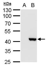 XRCC3 Antibody in Western Blot (WB)