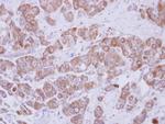 TIP30 Antibody in Immunohistochemistry (Paraffin) (IHC (P))