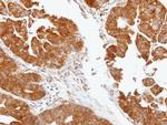 TDP1 Antibody in Immunohistochemistry (Paraffin) (IHC (P))