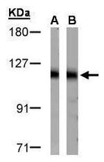 DDB1 Antibody in Western Blot (WB)