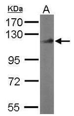 DDB1 Antibody in Western Blot (WB)