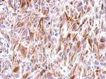 FZD9 Antibody in Immunohistochemistry (Paraffin) (IHC (P))